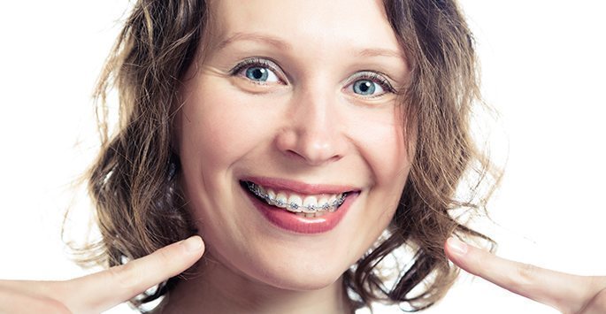 Featured image for “Straight Talk On Dental Braces Options For Adults”