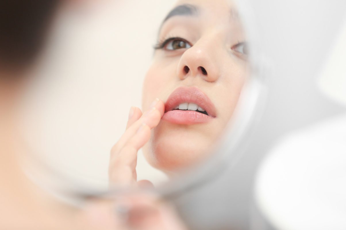 Young woman with cold sore looking in mirror at home