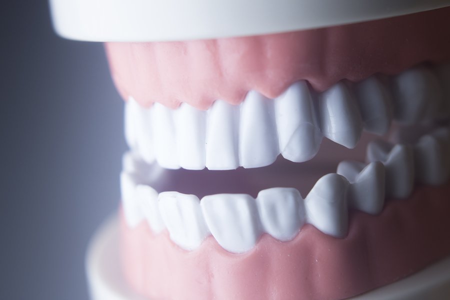 Dental tooth dentistry student learning teaching model showing teeth roots gums gum disease tooth decay and plaque.