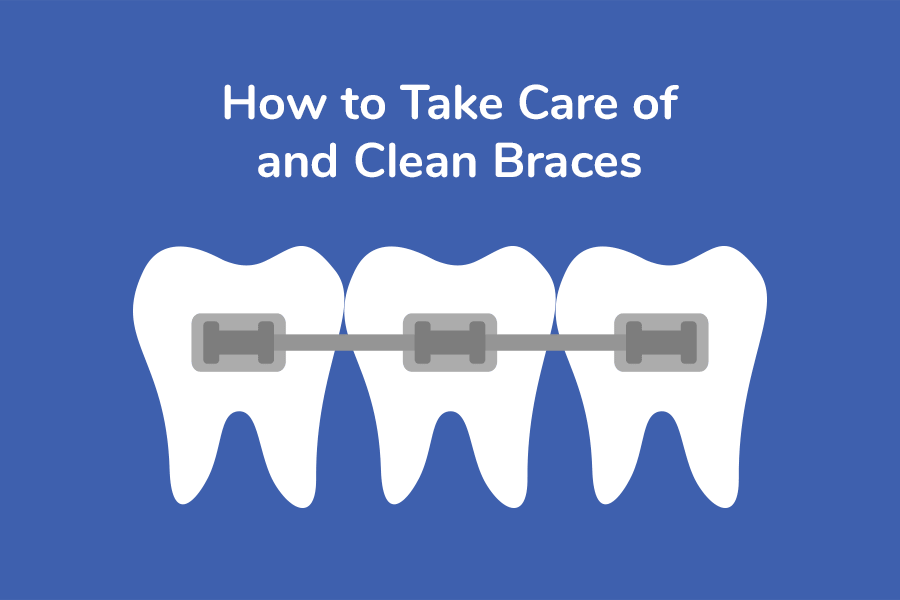 Featured image for “How to Take Care of and Clean Braces”