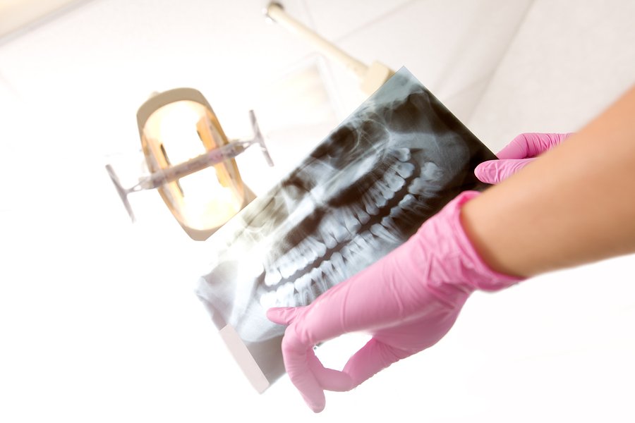 Featured image for “Dental X-rays: 7 of Your Top Questions, Answered!”