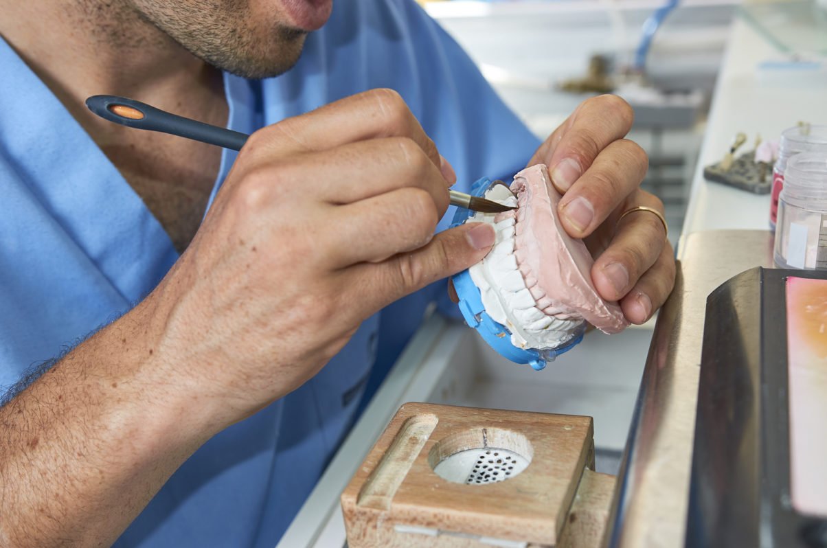 Dental Technician With Ceramic Dental Implants