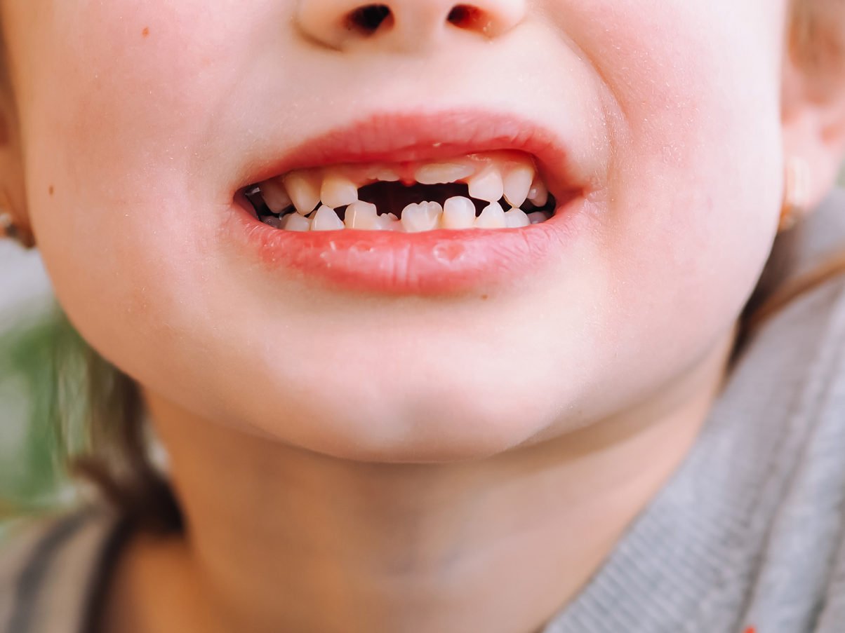 When You Should Expect Your Child's Teeth to Come in & Fall Out