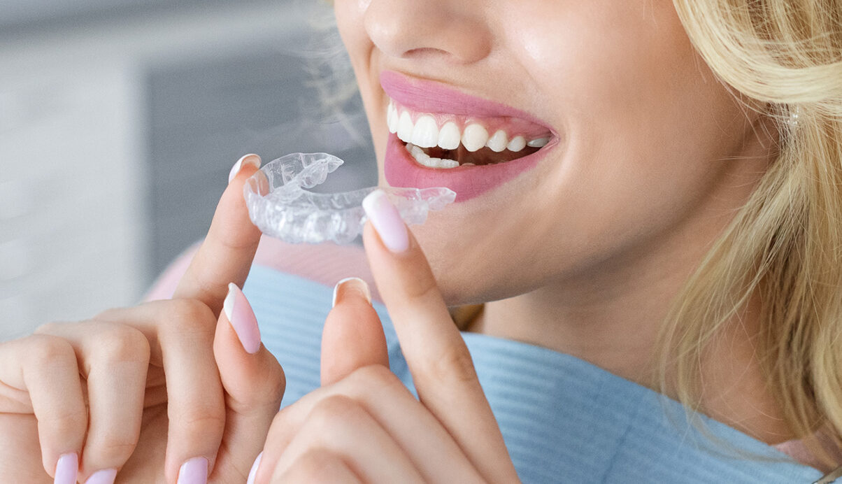 image of a woman holding aligner in front of her mouth
