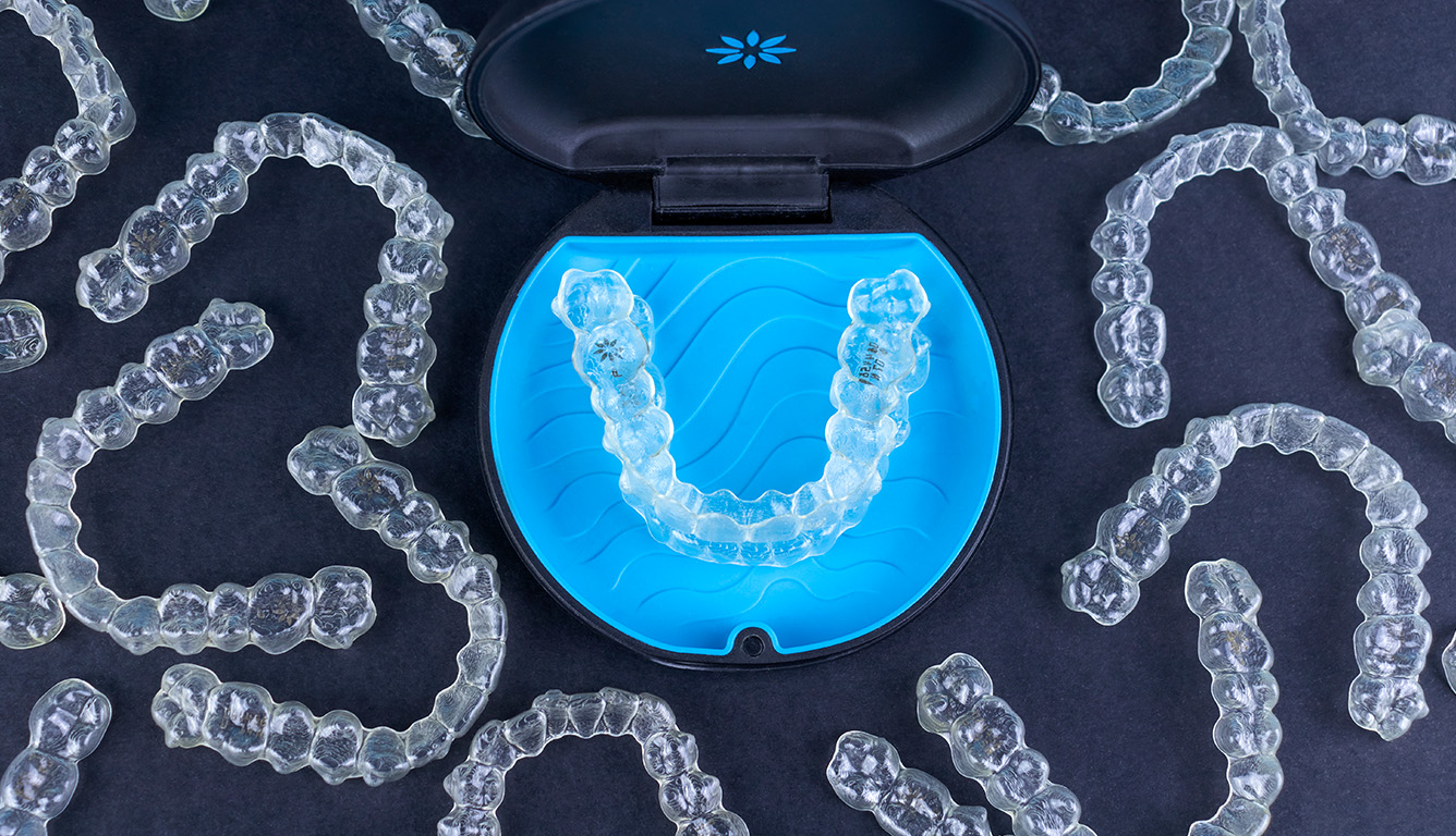 The Unique Edge of Invisalign An Analysis Dentist Near Me Gentle Dental