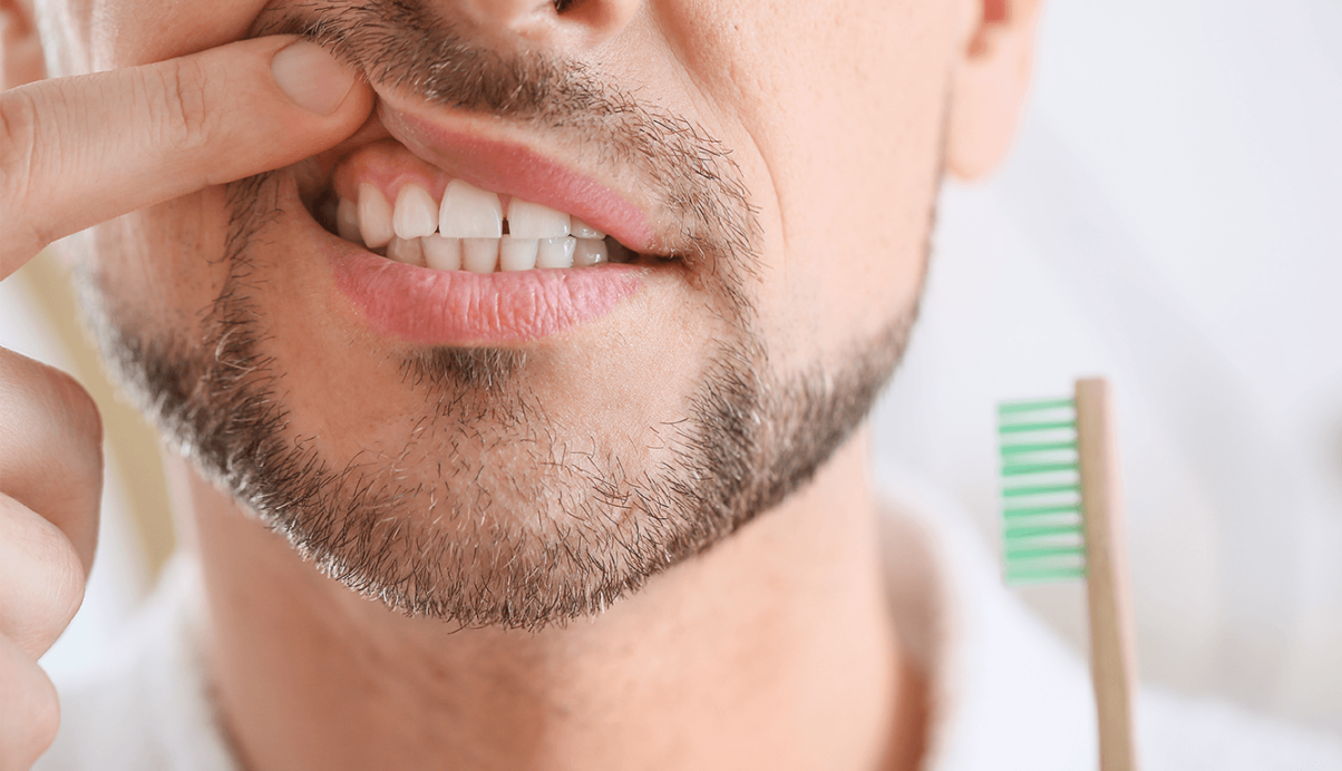 man lifting lip to show gums