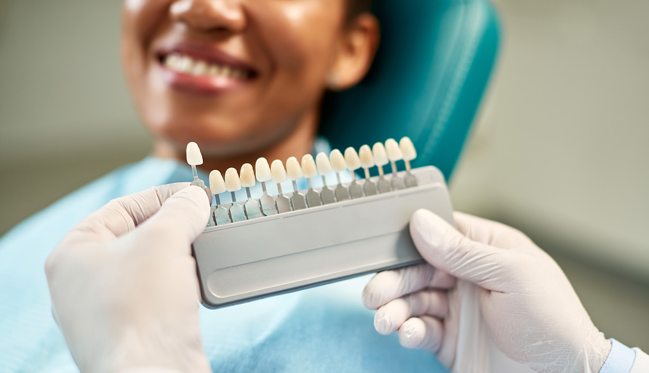 Everything You’ve Ever Wondered About Dental Veneers Dentist Near Me