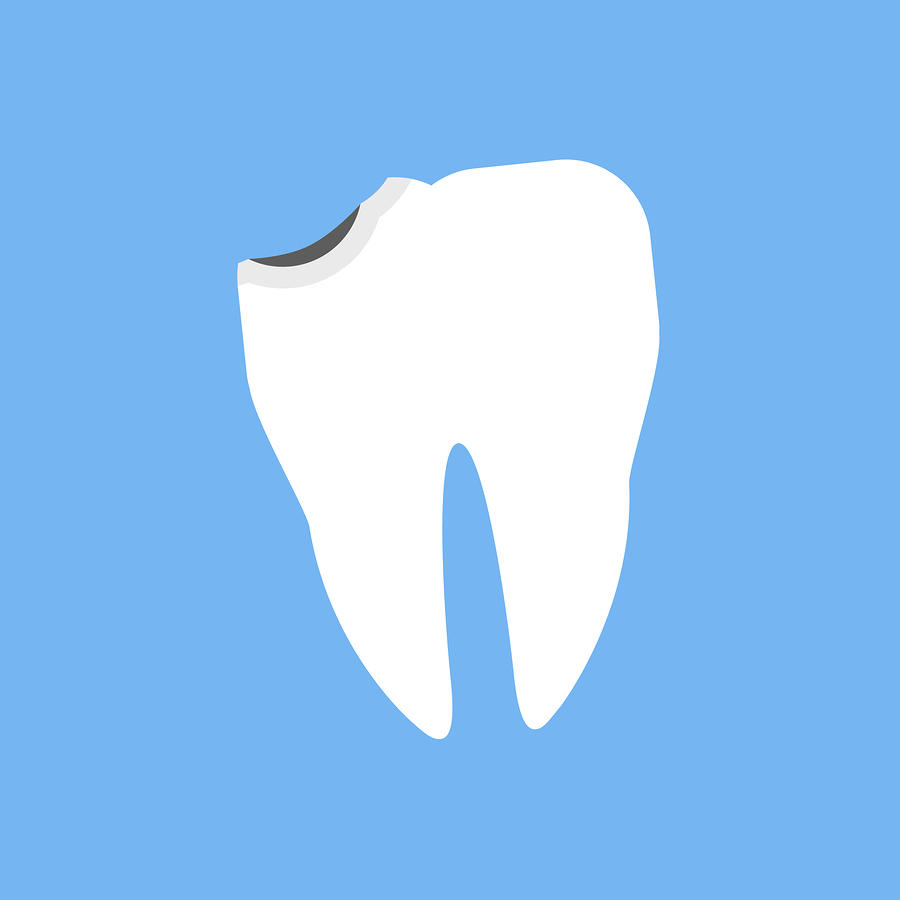 Featured image for “Chipped Tooth Causes, Treatments, & Recovery”