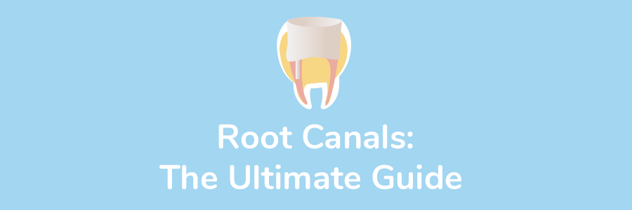 Featured image for “Root Canals: The Ultimate Guide”